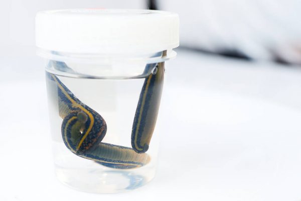 hirudotherapy, leeches as therapy, prevention of varicose veins Hirudotherapy procedure, hirudotherapy, leeches as therapy, prevention of varicose veins